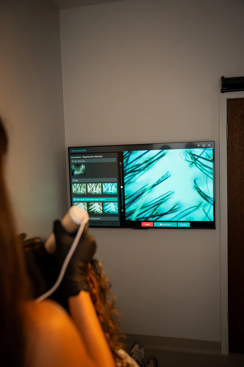 We examine a client’s scalp with AI trichoscopy in our Brighton clinic
